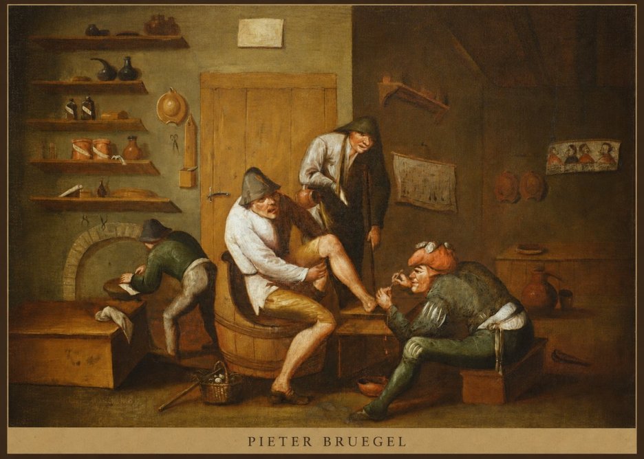 Pieter Bruegel The Foot Operation No5 - Póster